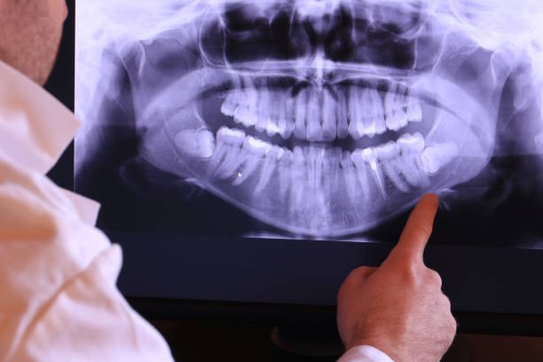 Best Urgent Tooth Repair  in Decherd, TN